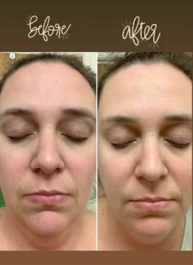 Masque facial Hello Glow pour éclaircir et lisser-Bella&Bear